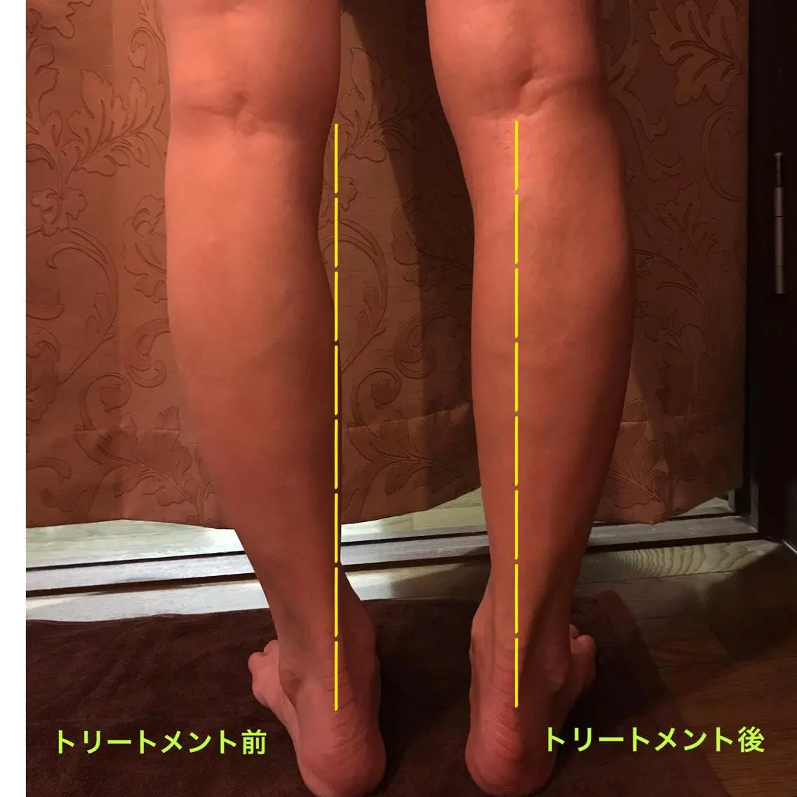 代表 MOMOのエステ・リラクイメージ