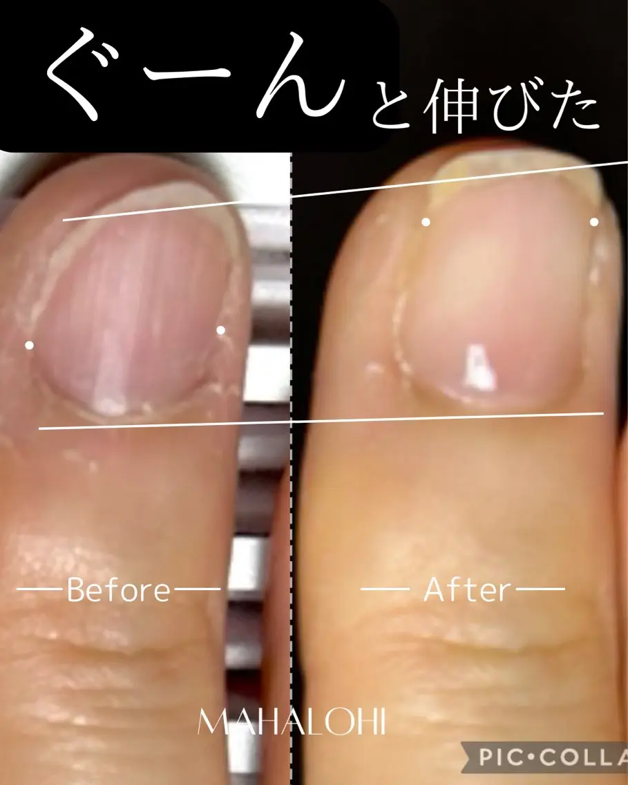 ネイル 深爪・自爪育成専門 MAHALOHIのネイルデザイン