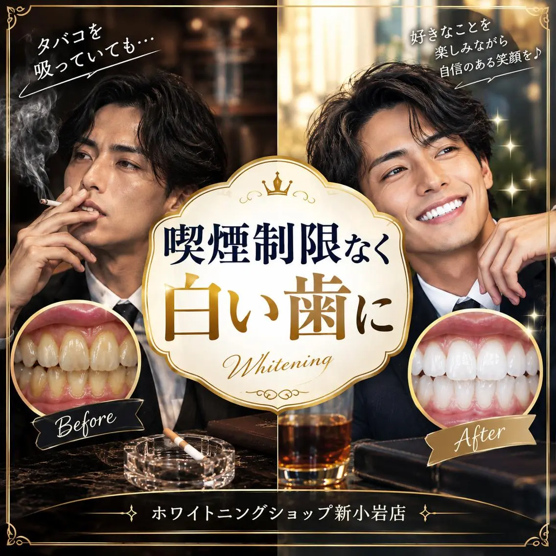 メンズ その他 ホワイトニング ショップ新小岩店のその他イメージ