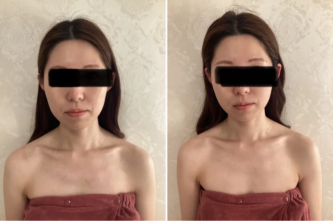 小顔矯正+フェイシャルリンパマッサージ+ヘッドスパ60分コースの写真
