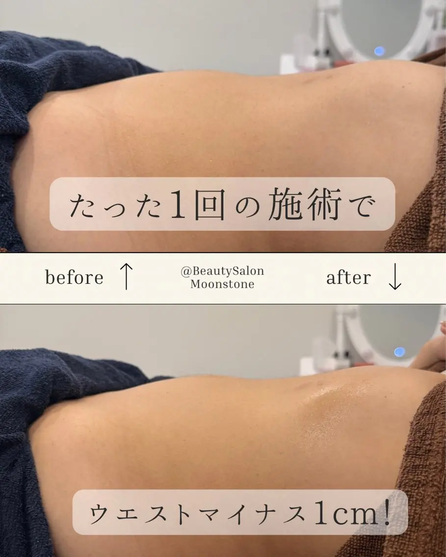 Moonstone 腸活ダイエット・脱毛のエステ・リラクイメージ