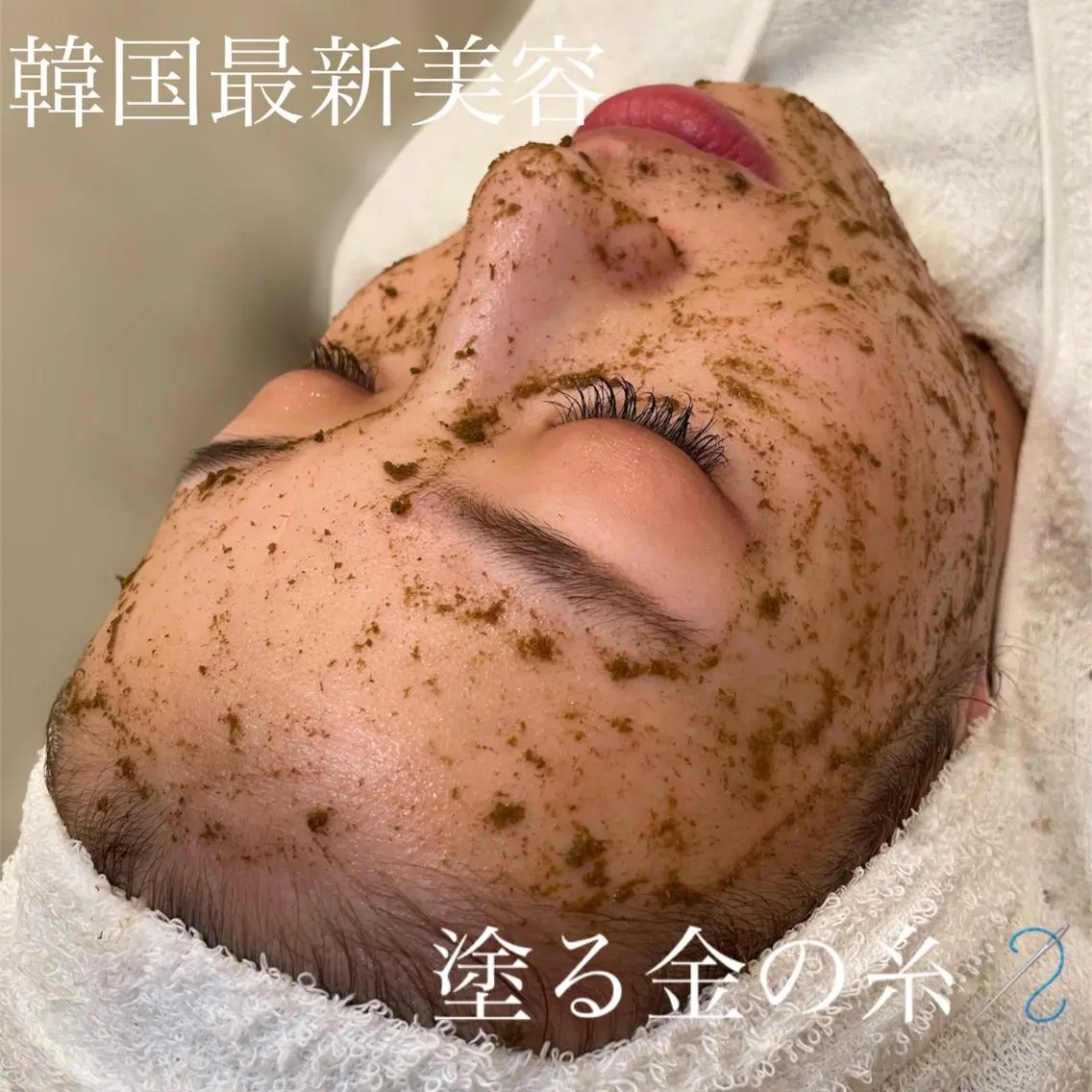 5月限定!超得クーポン配布中✨金の糸ハーブピーリングで肌質改善【ニキビ・ニキビ跡・毛穴・くすみ】※剥離なしの写真