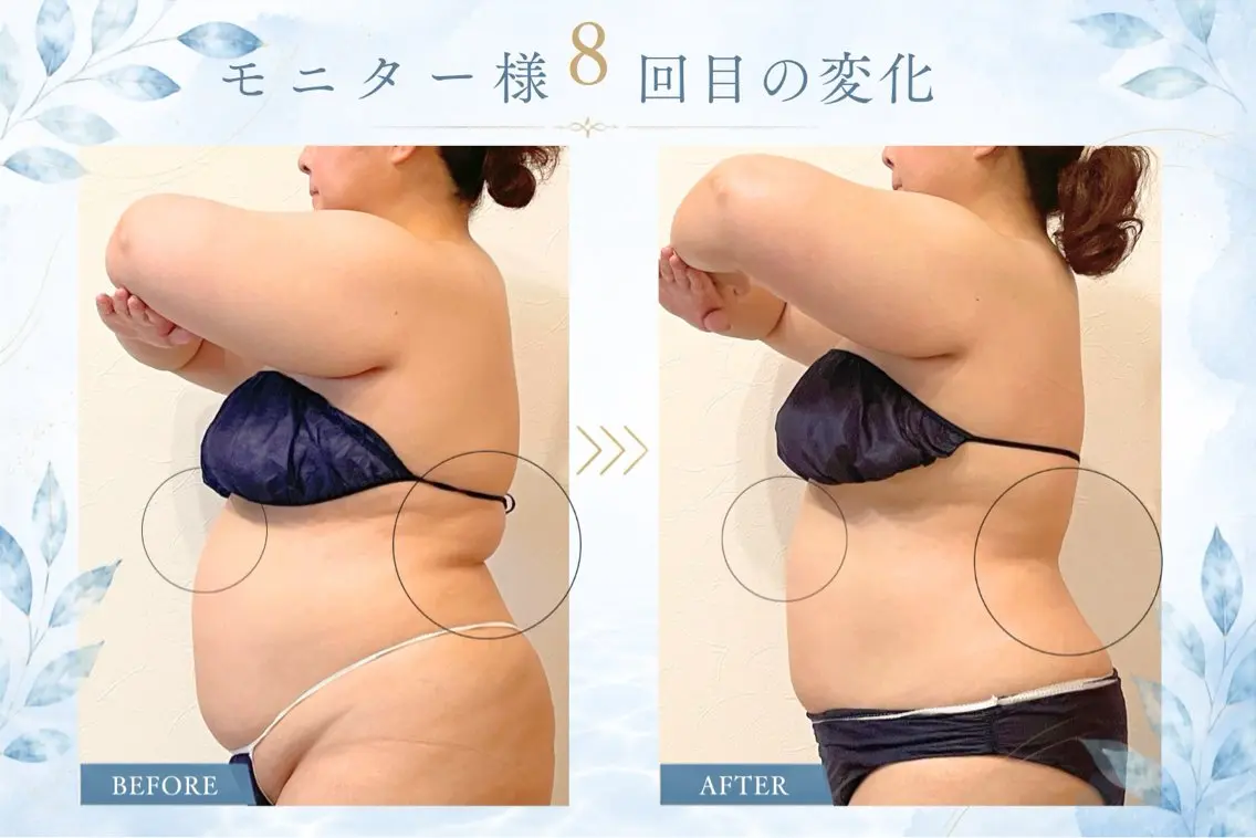 エステ CLeanse Miyakoのエステ・リラクイメージ