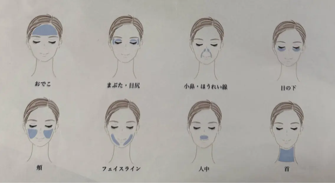【高周波で引き締め】最新美容で小顔に!サーマトリックス1部位の写真