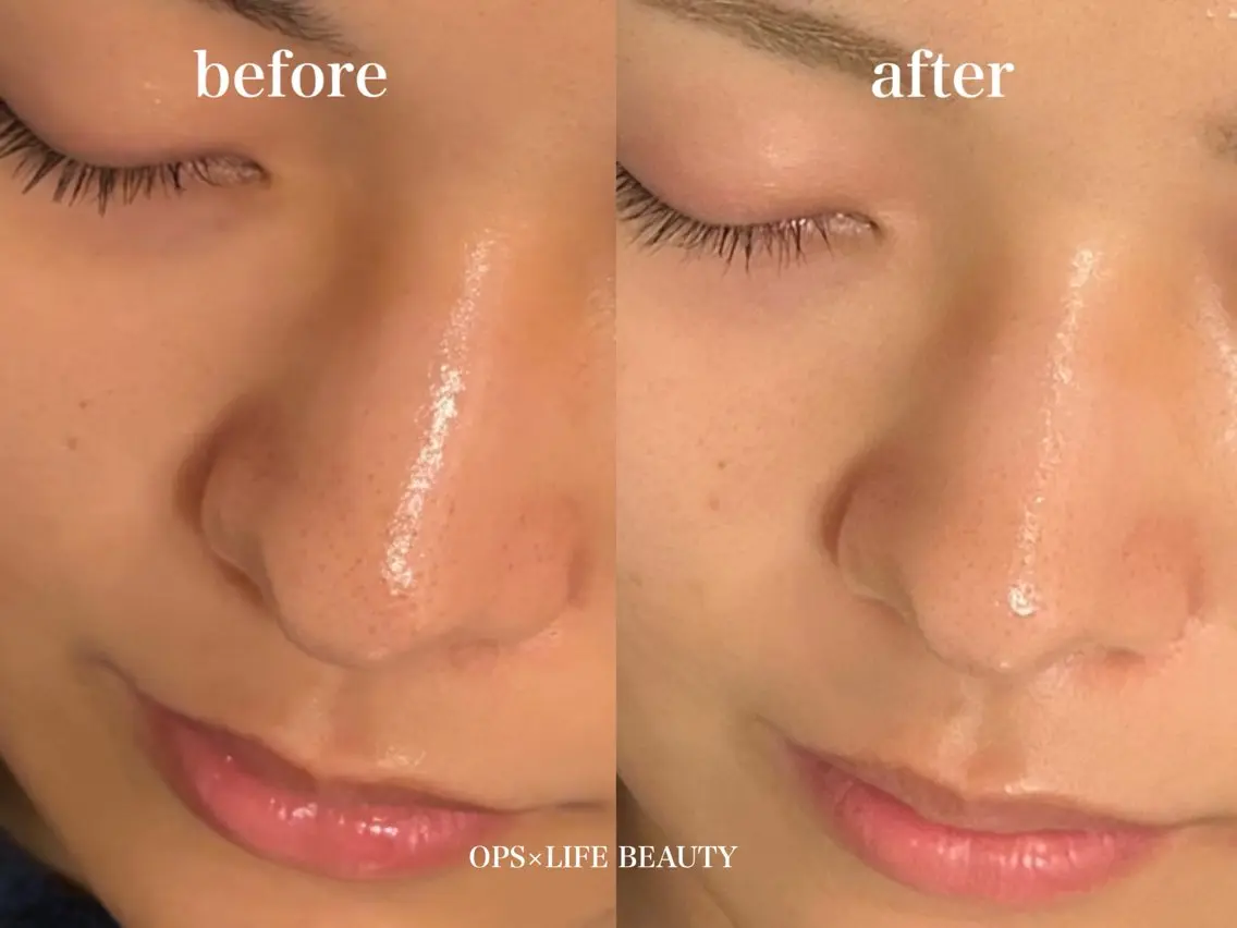 エステ OPS×LIFE BEAUTY/maiのエステ・リラクイメージ