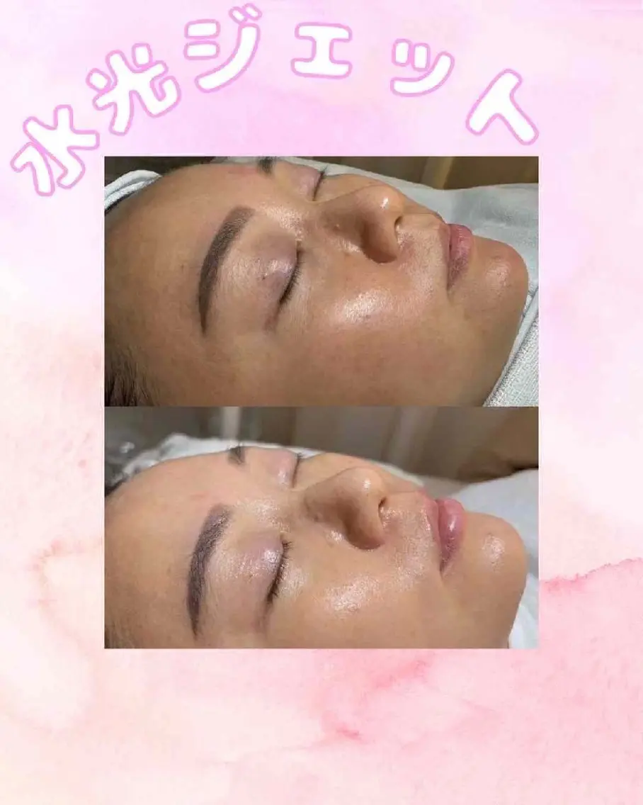 マツエク・マツパ 結婚式・ブライダル aliaハーブ水光店 エステティシャン募集のエステ・リラクイメージ