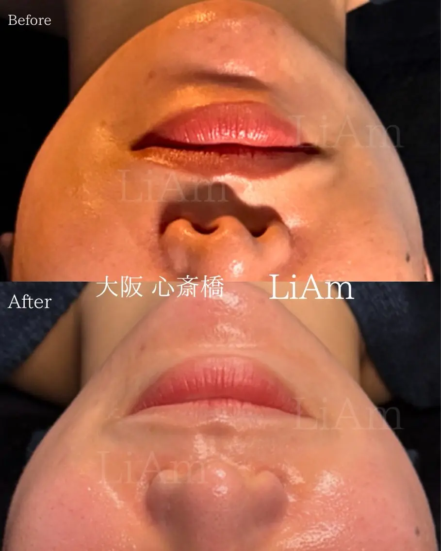 LiAm《韓国管理/ 小顔/脂肪ケア》のエステ・リラクイメージ