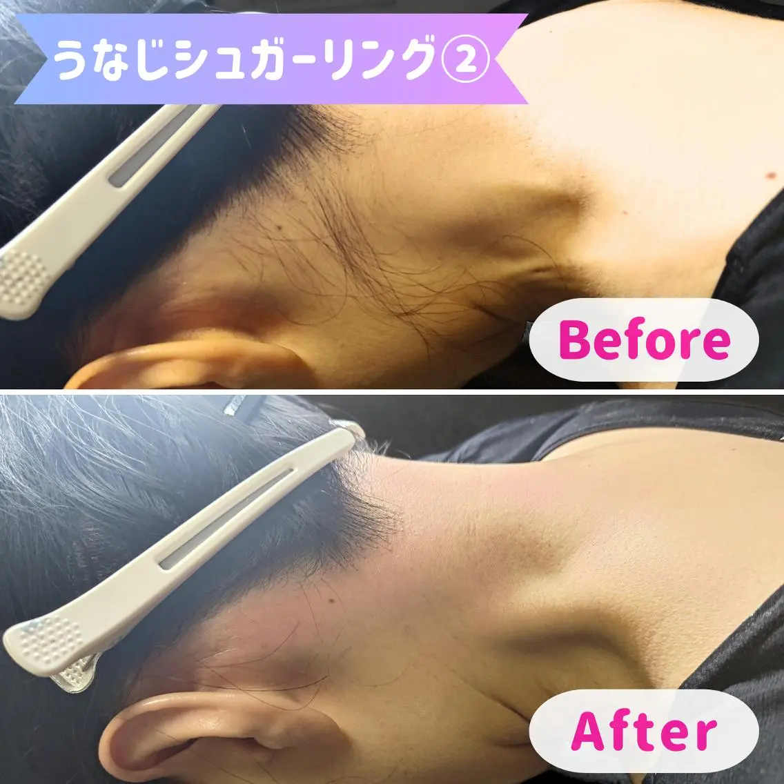 脱毛 SUCRE銀座 ヤマグチのエステ・リラクイメージ