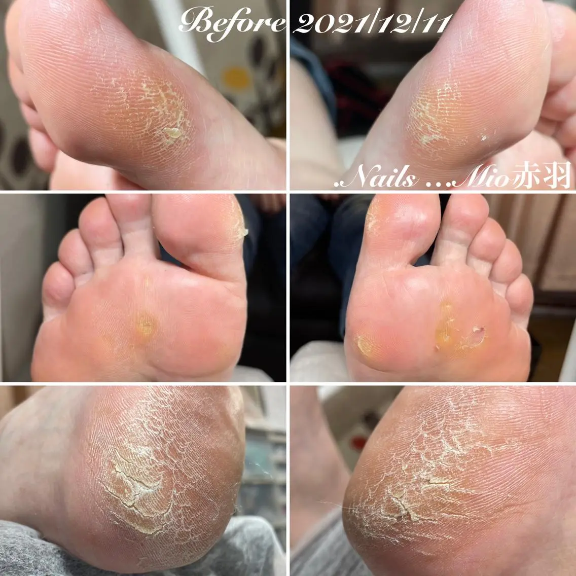 ネイル フットネイル .Nails Mio 赤羽西ネイルサロンのネイルデザイン