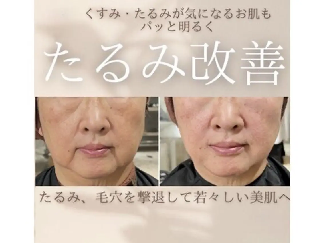 エステ 服部 先生のエステ・リラクイメージ