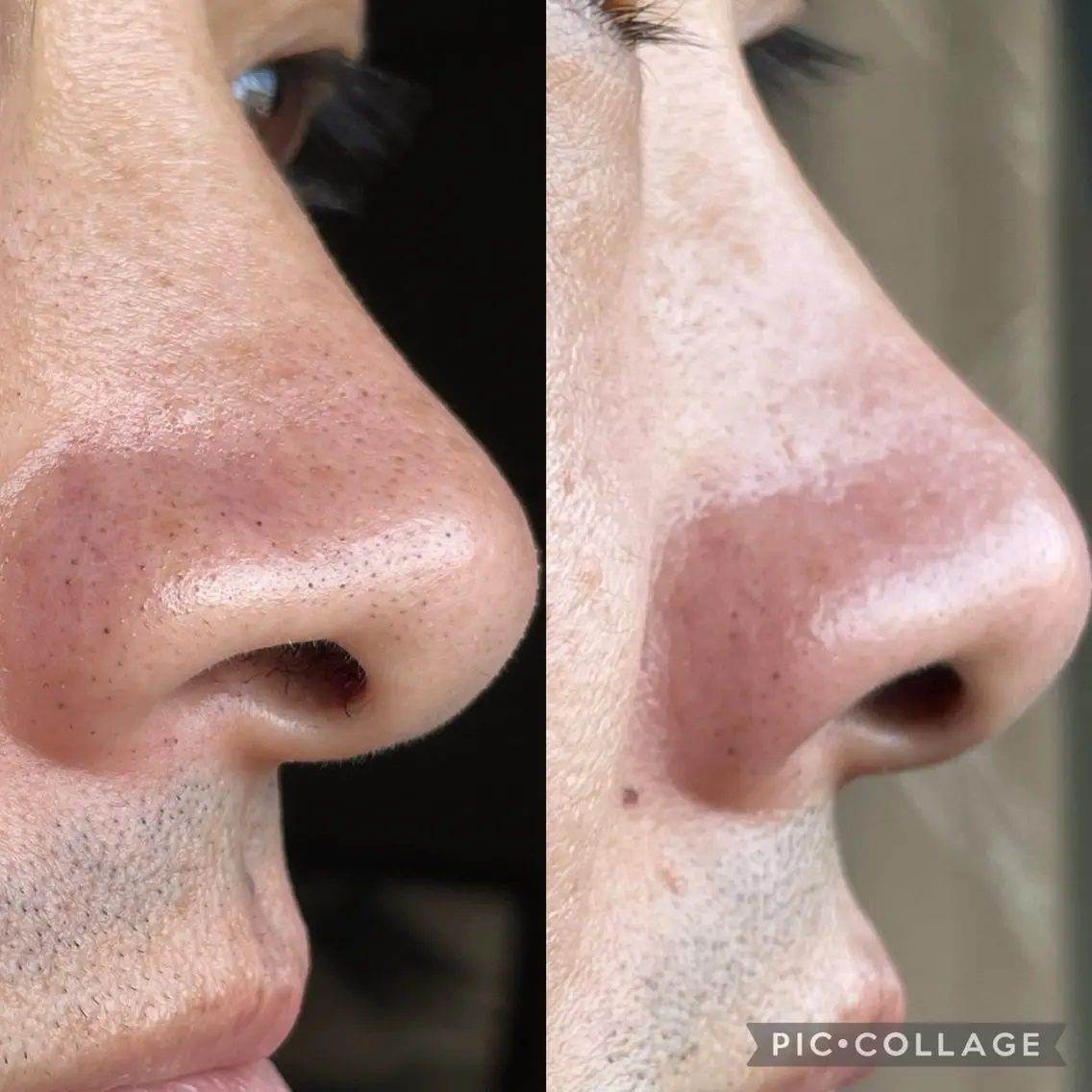 メンズ エステ 美 Faceのエステ・リラクイメージ