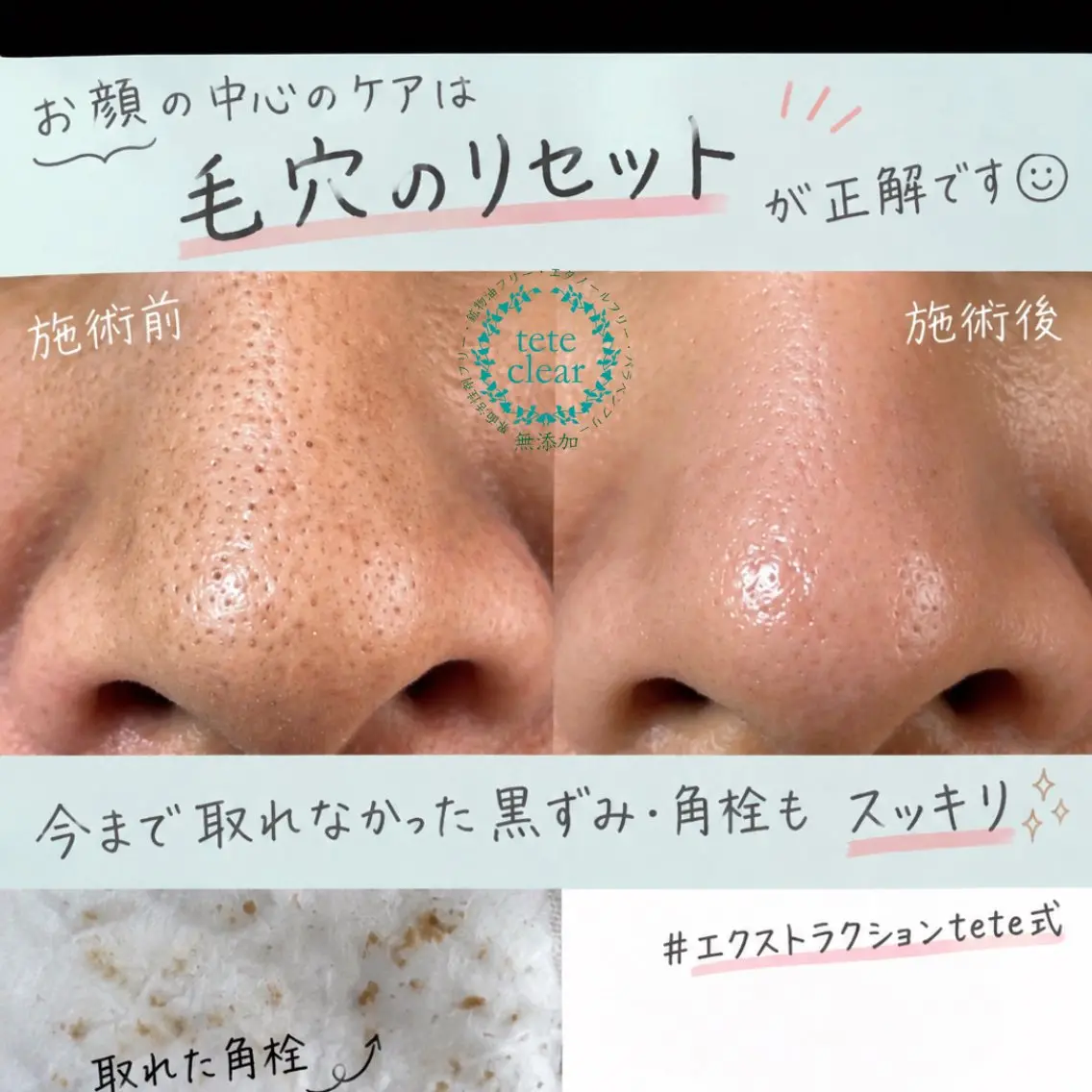 エステ SOLEILnail &beautyのエステ・リラクイメージ