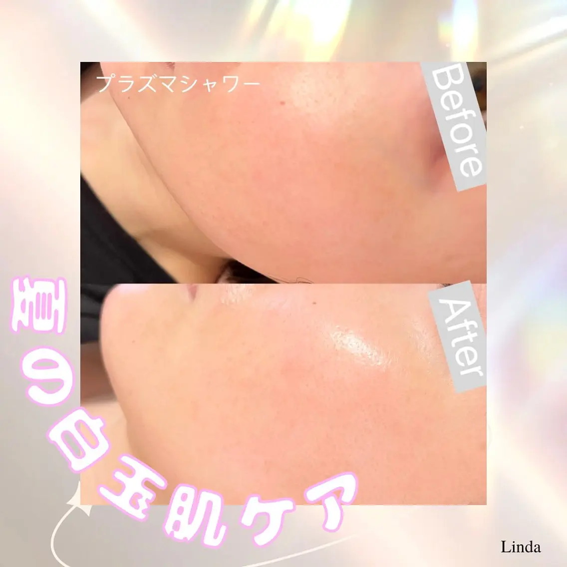 エステ 小顔&毛穴・肌質改善 LINDA西宮 AIのエステ・リラクイメージ