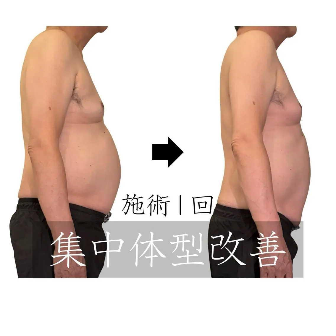 【楽痩せ!】体の機能・骨格・脂肪へ全方位アプローチ★高周波美容整体180分の写真