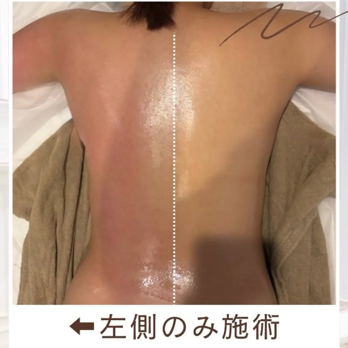 🫧【25歳以下限定】シークレットYボディケアの写真