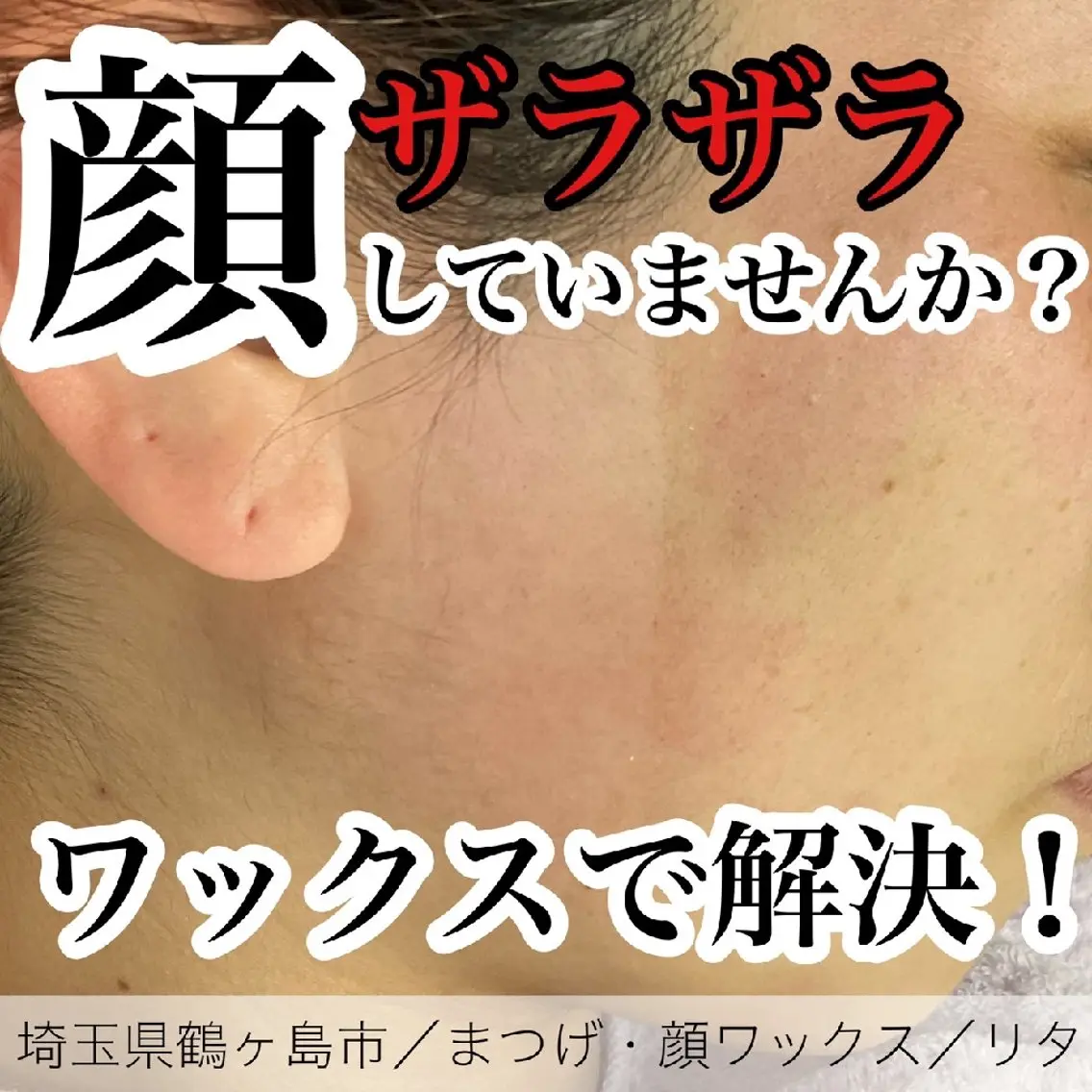 脱毛 Rita eye&waxのその他イメージ