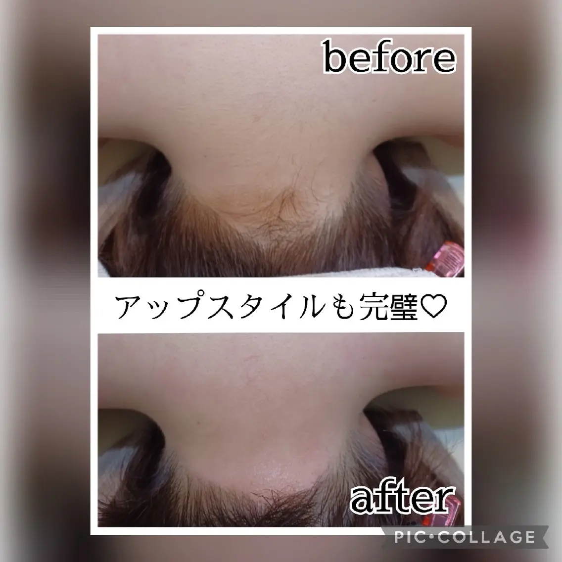 【女性】うなじ(肩、もみあげ込)の写真