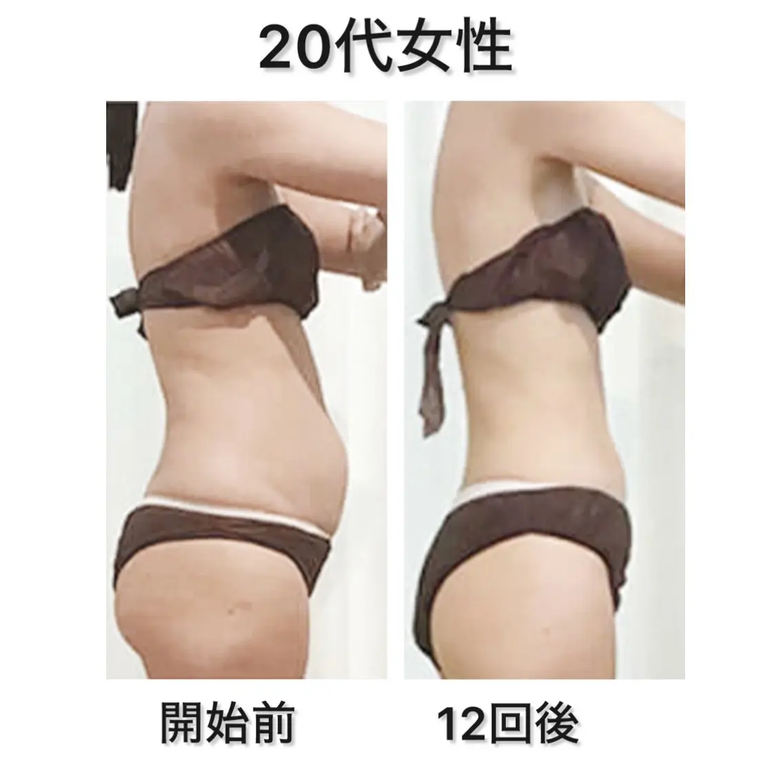 【ミニモ学割】新規様✨ウエストに腹筋を付けて引き締める電磁パルスマシン25分(腹筋約2.5万回分)¥3,000の写真