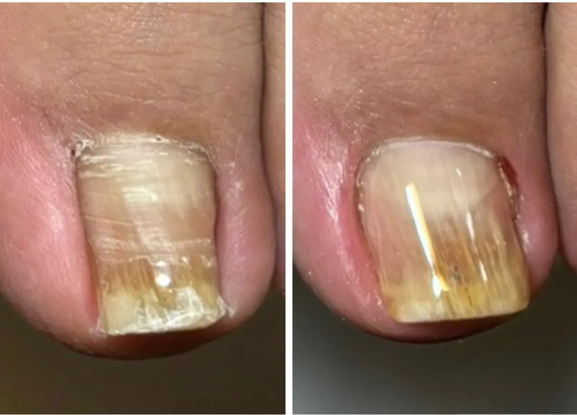 ネイル Luar nailのネイルデザイン