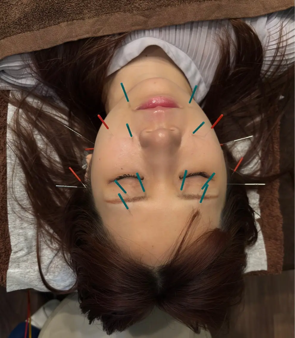 エステ リラク 小林整骨院本町 美容鍼roomのエステ・リラクイメージ