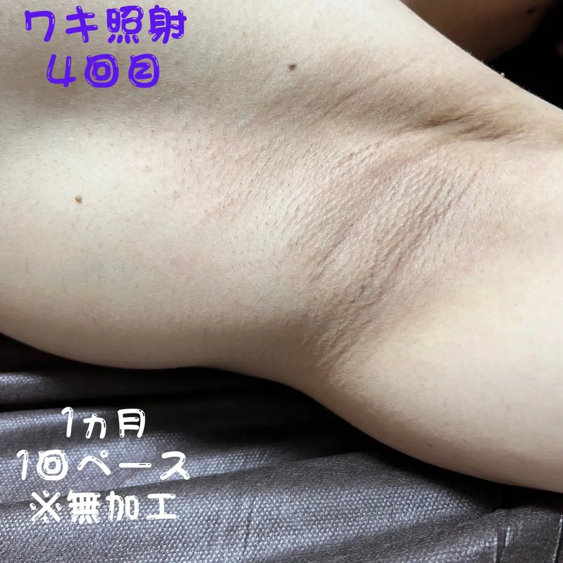 メンズ キッズ 脱毛 メンズ脱毛フェリッセ /男女🆗キッズ🆗のエステ・リラクイメージ