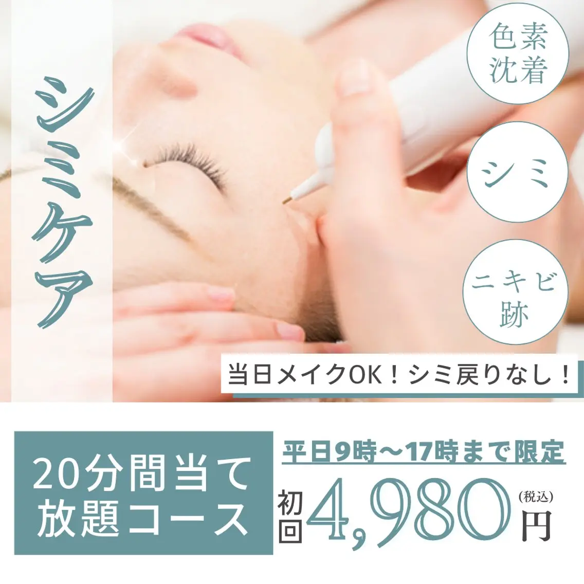【平日9時〜17時迄限定❗️】✨シミ取り放題20分✨薄いシミも濃いシミもポロッ!※3〜7日剥離期間ありの写真