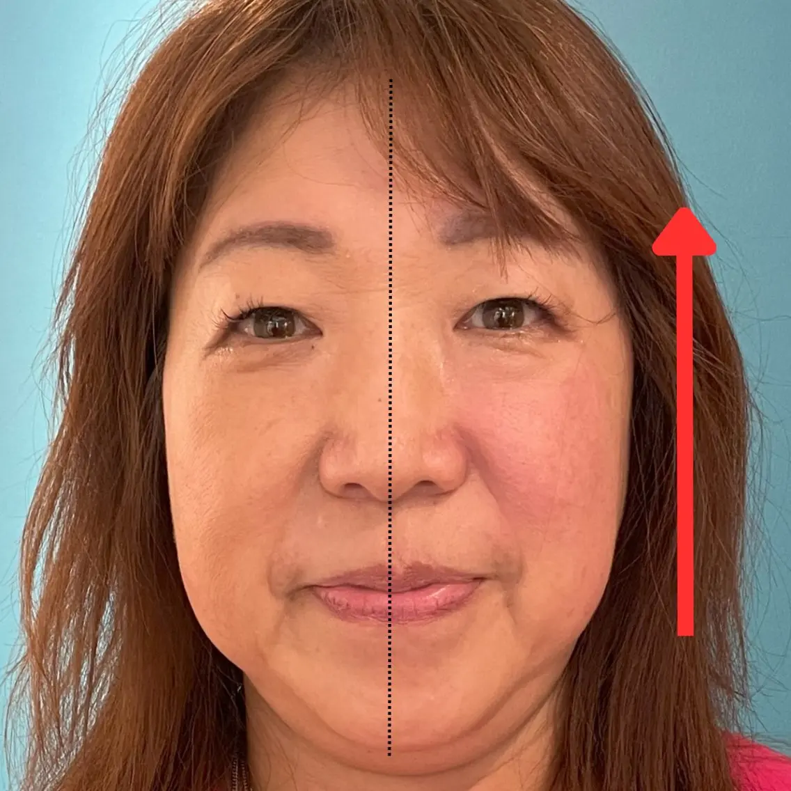 エステ リラク Nexfit for Beauty小顔矯正のエステ・リラクイメージ