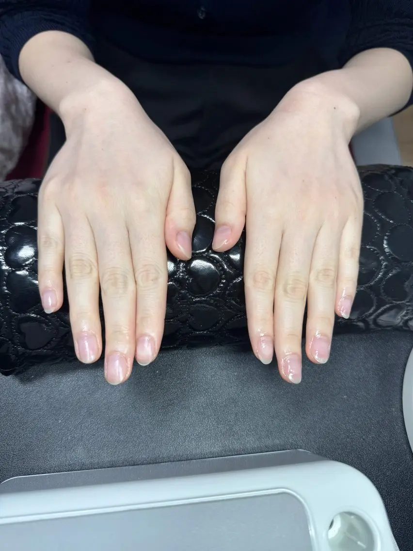 ネイルオフの写真