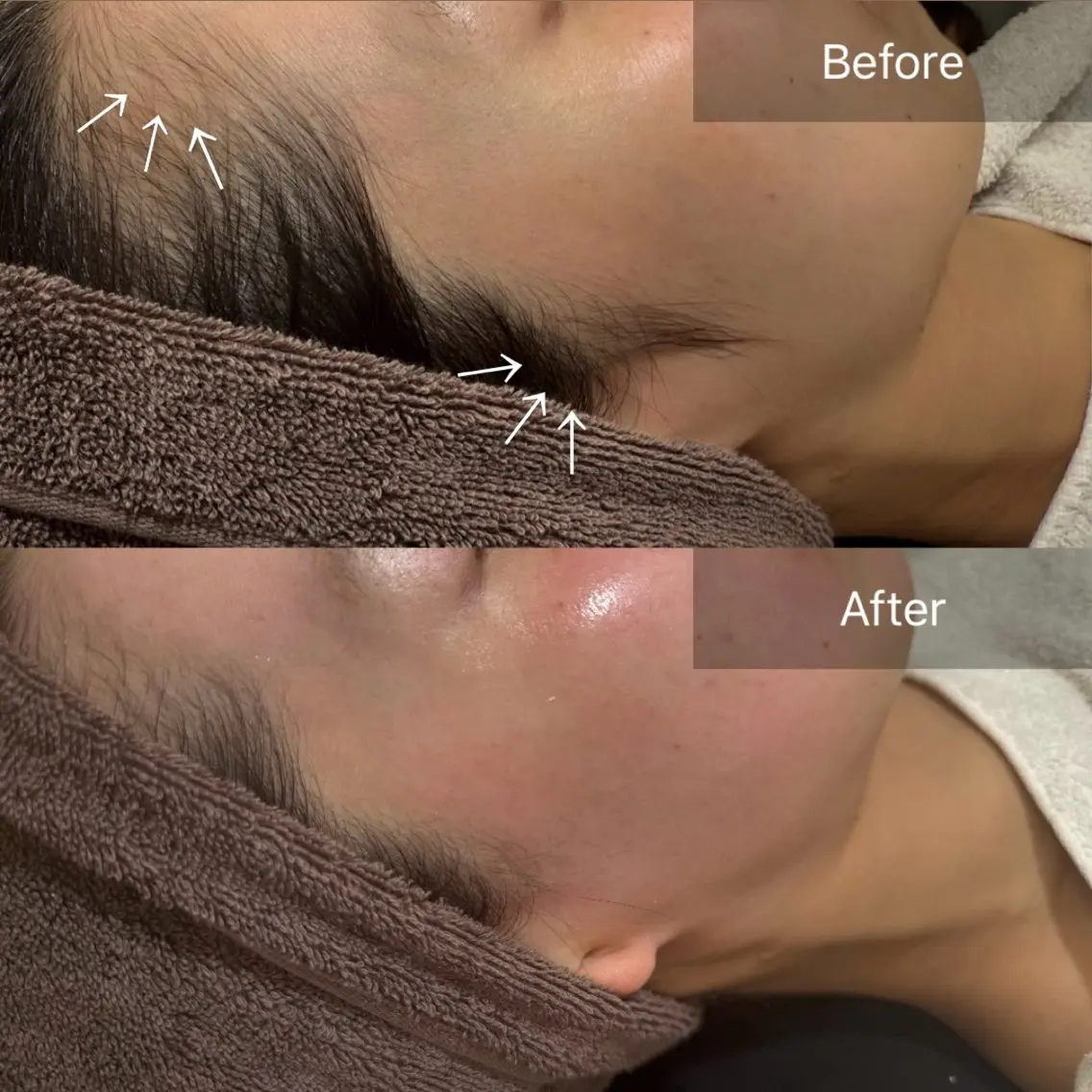 脱毛 enine フェイスWAXのエステ・リラクイメージ