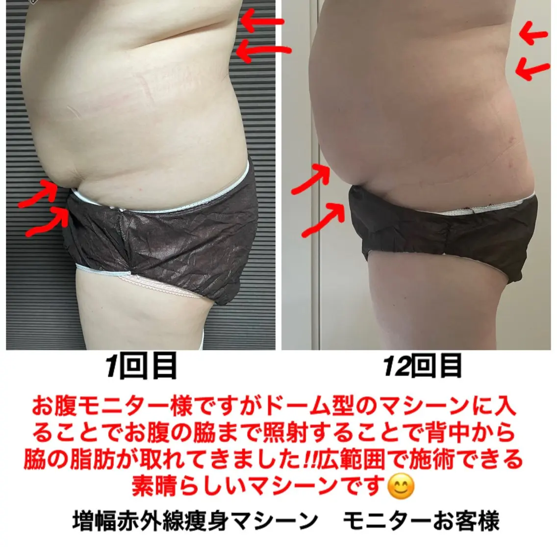 ネイル・エステサロン UILANIのエステ・リラクイメージ