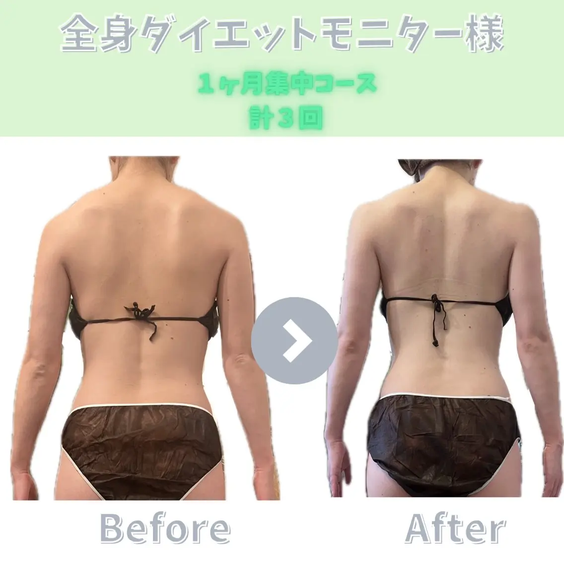 エステ リラク 【ダイエット専門店】 エステサロン&Kのエステ・リラクイメージ