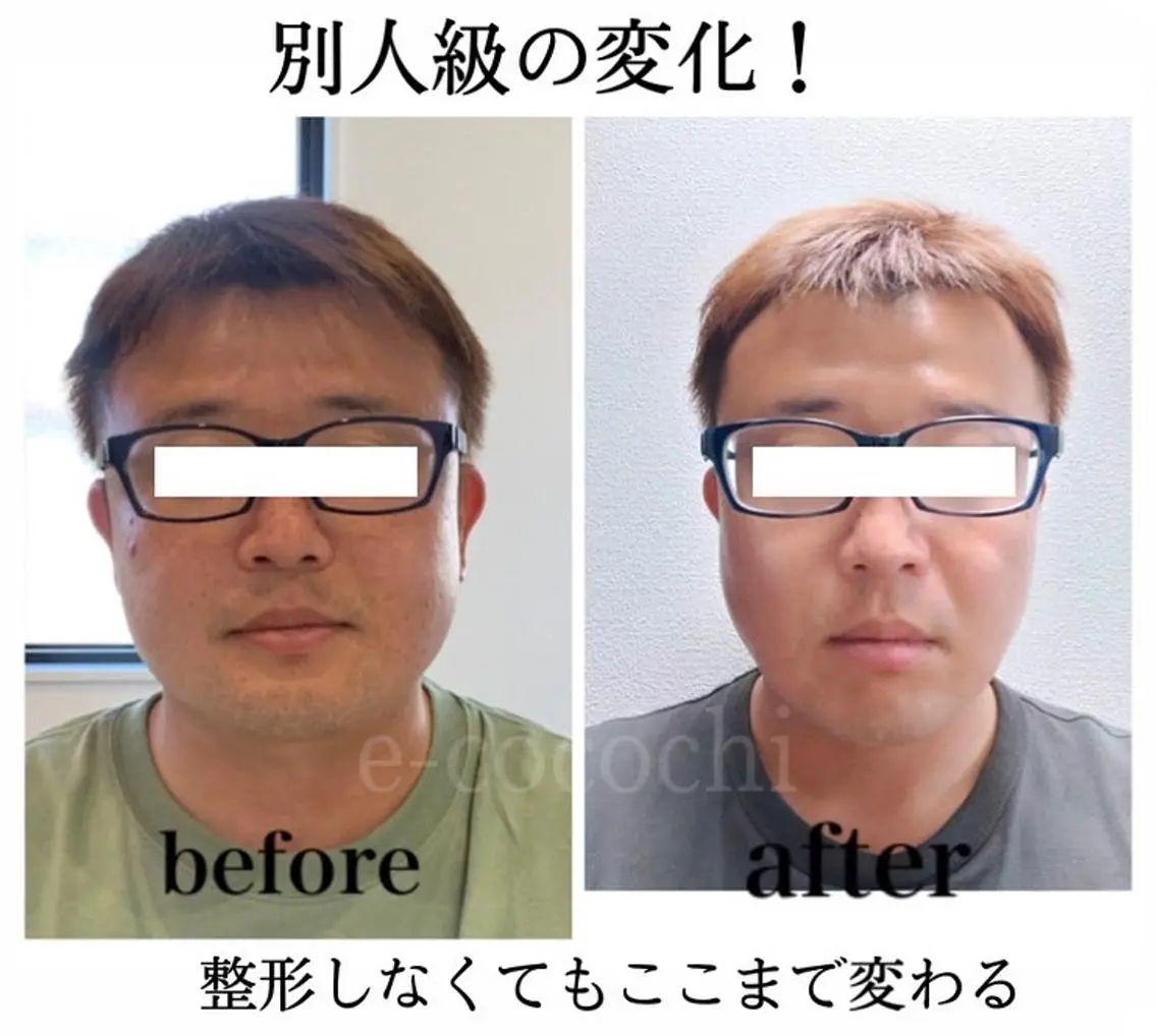 エステ リラク 小顔と ヘッドスパのお店のエステ・リラクイメージ