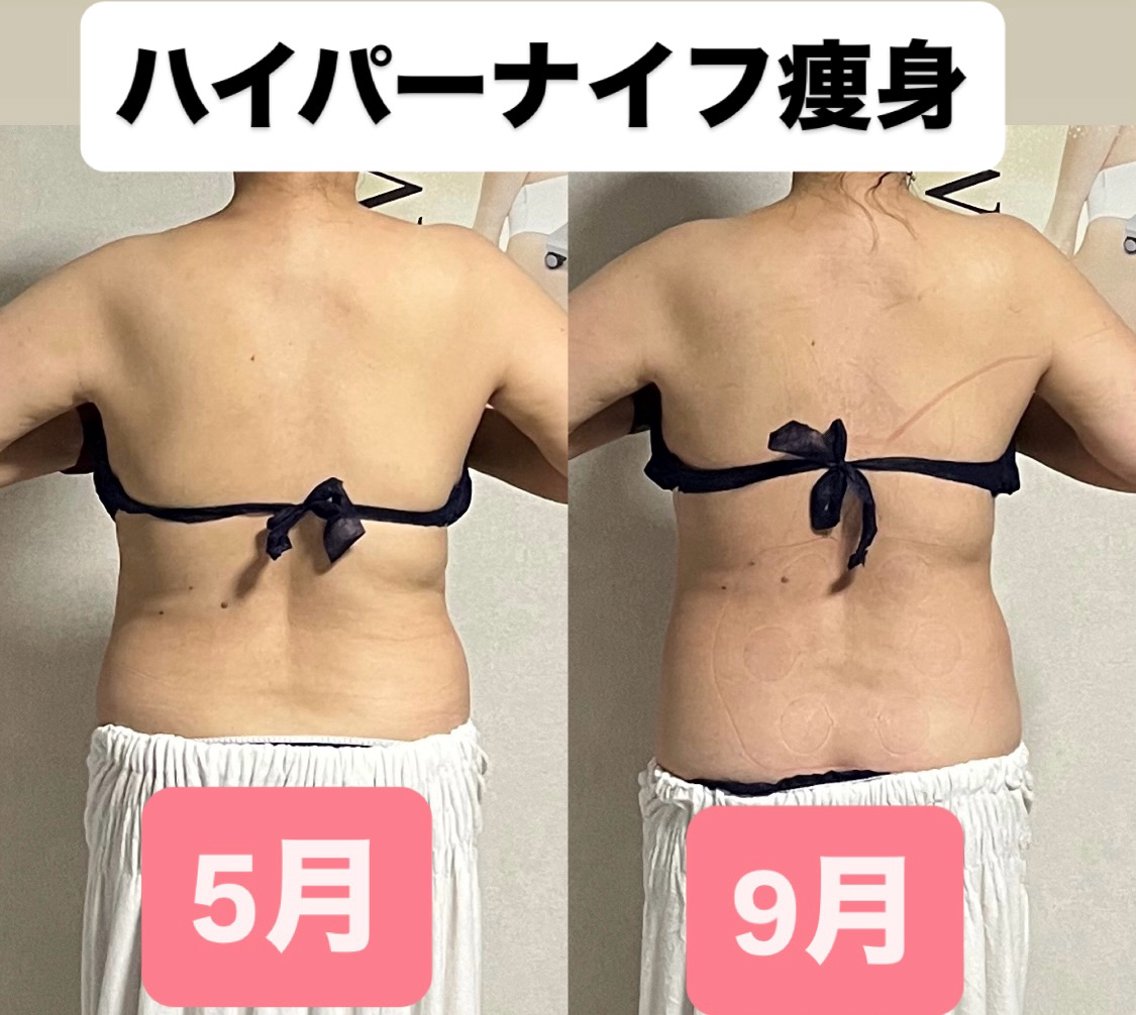 ハイパーナイフ専門 熊田陽子のエステ・リラクイメージ