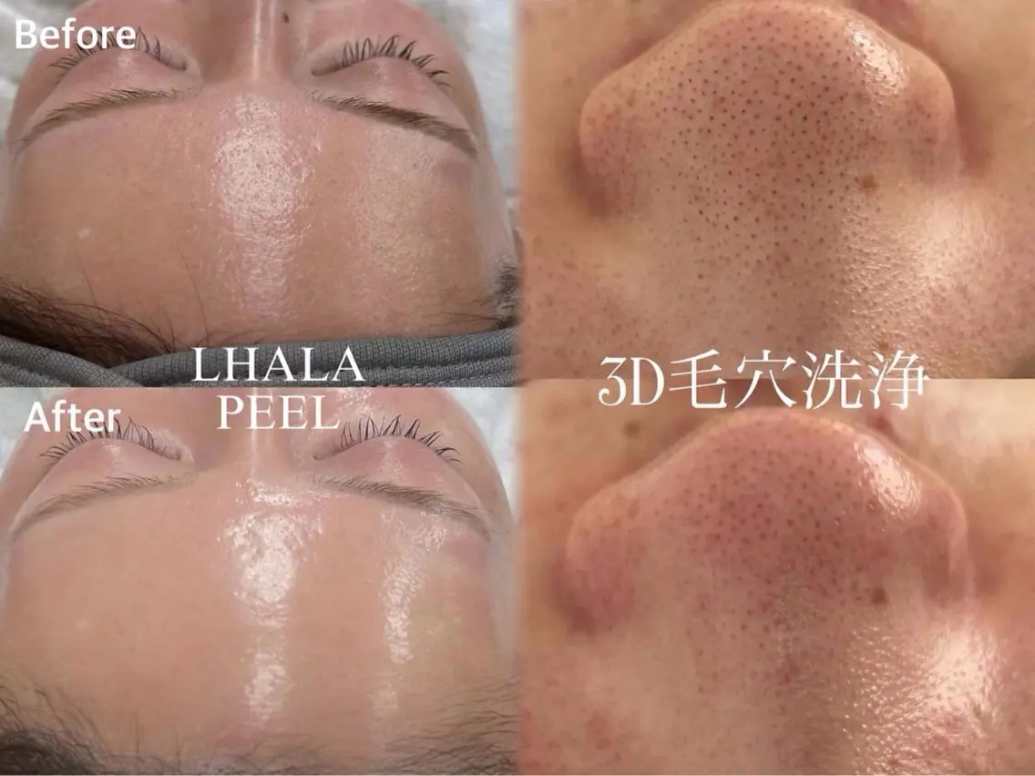 エステ リンパ×ハーブ蒸し TIARA.烏丸三条のエステ・リラクイメージ