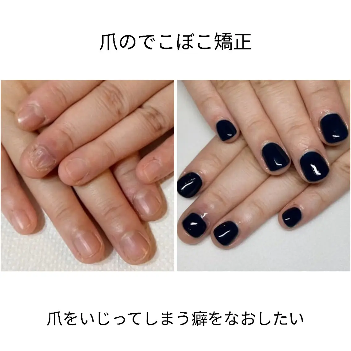 ネイル ネイルサロン アリュームのネイルデザイン
