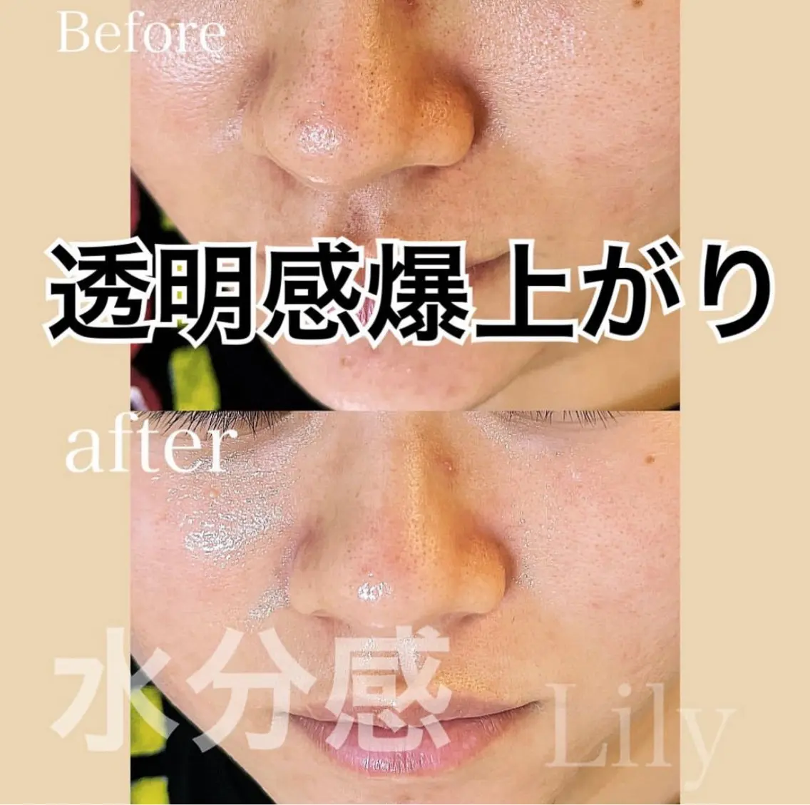 トータルビューティー サロンLilyのその他イメージ