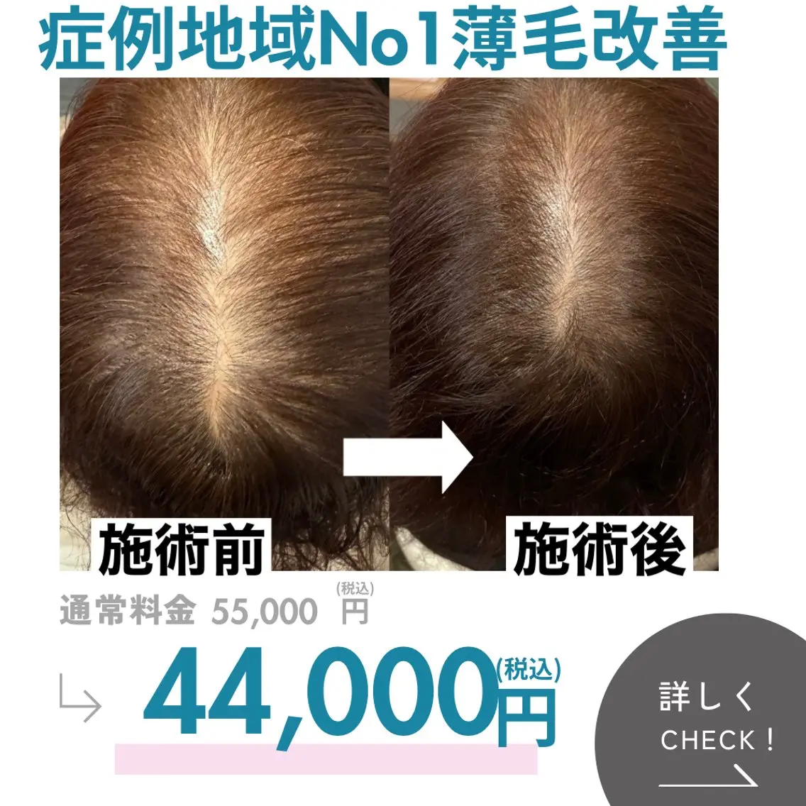 最速 毛穴シミ改善 いくえのその他イメージ