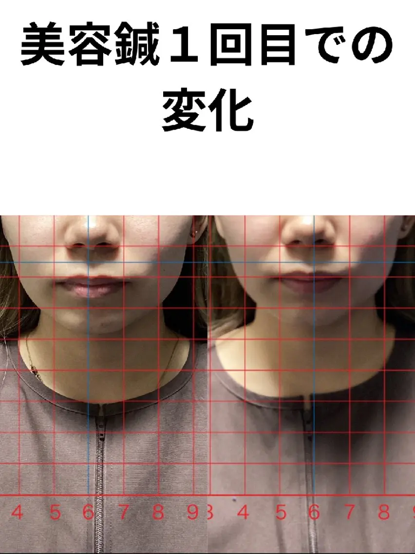 その他 鍼灸整体院 アレンジのその他イメージ