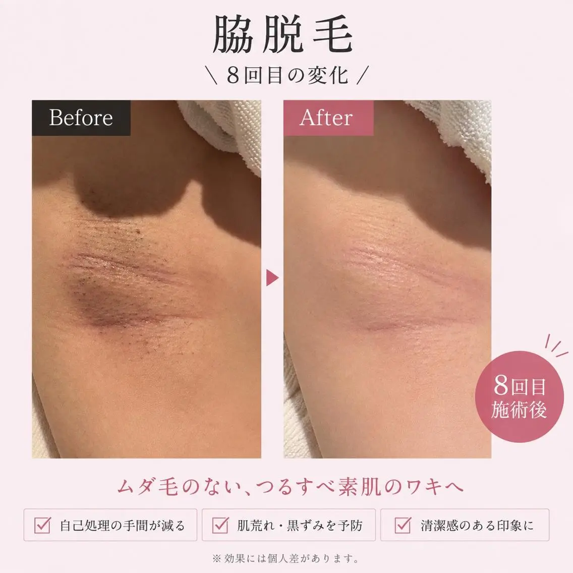 【美肌・脱毛専門店】 SARA 恵比寿店のエステ・リラクイメージ