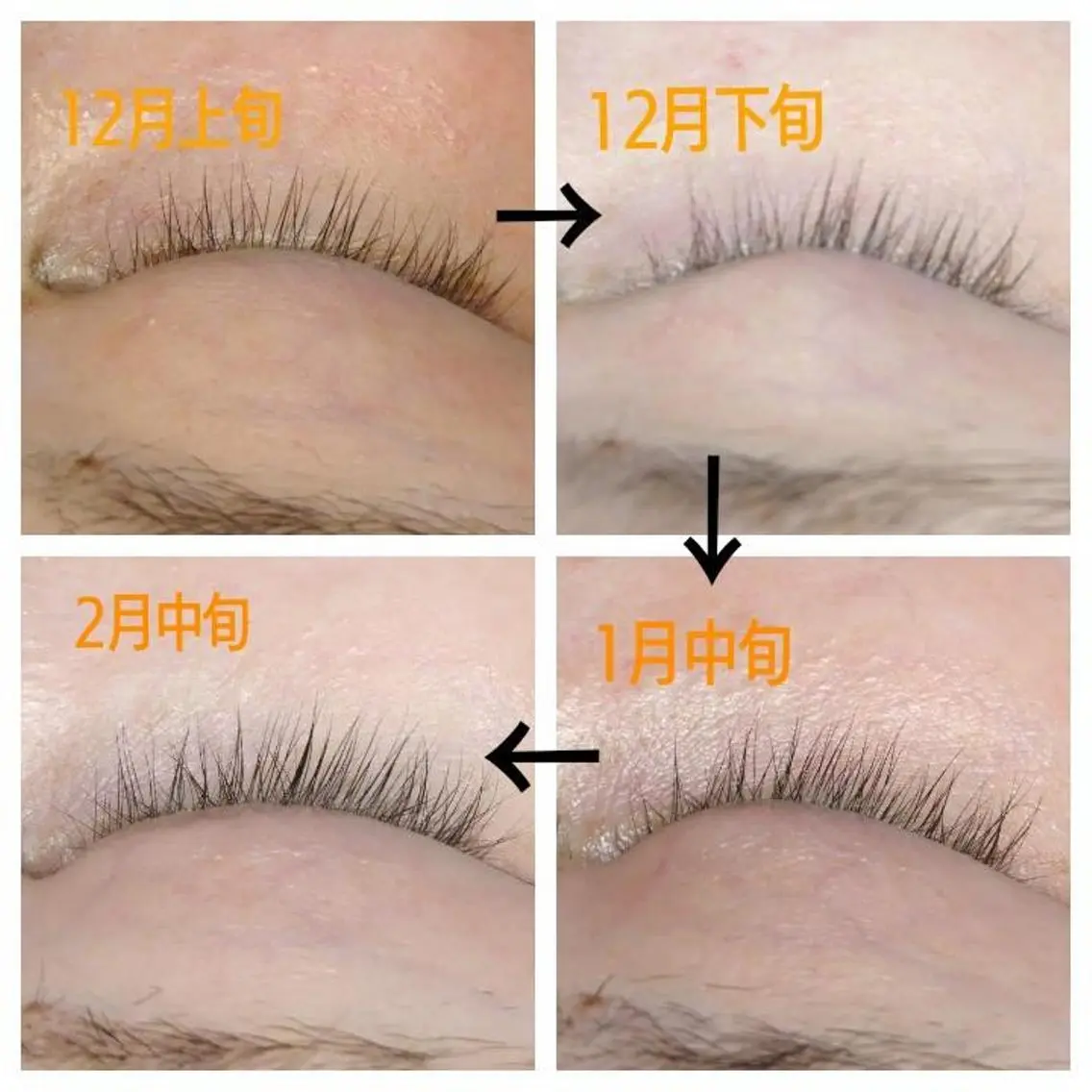 マツエク・マツパ その他 402 hakoishiのマツエク・マツパデザイン