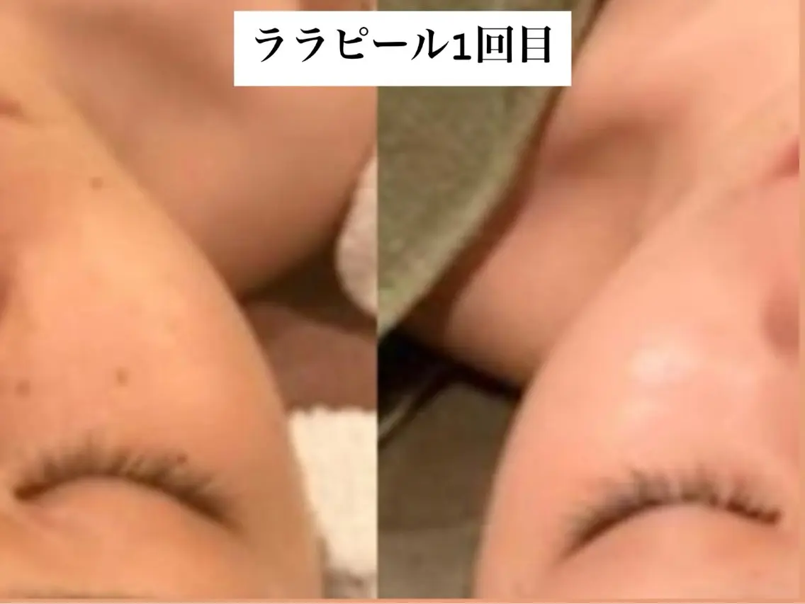エステ BIJOU八井 美加のエステ・リラクイメージ