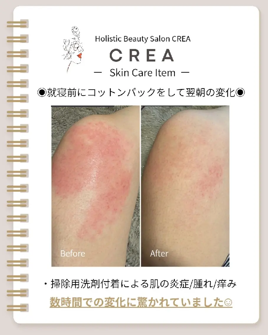☾⭒肌質改善|脳首肩 疲労解消CREA⭒☽のエステ・リラクイメージ