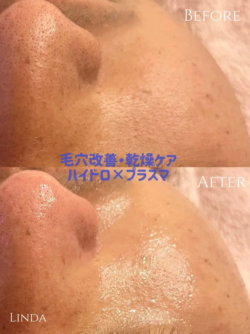 小顔&毛穴・肌質改善 LINDA西宮 AIのエステ・リラクイメージ
