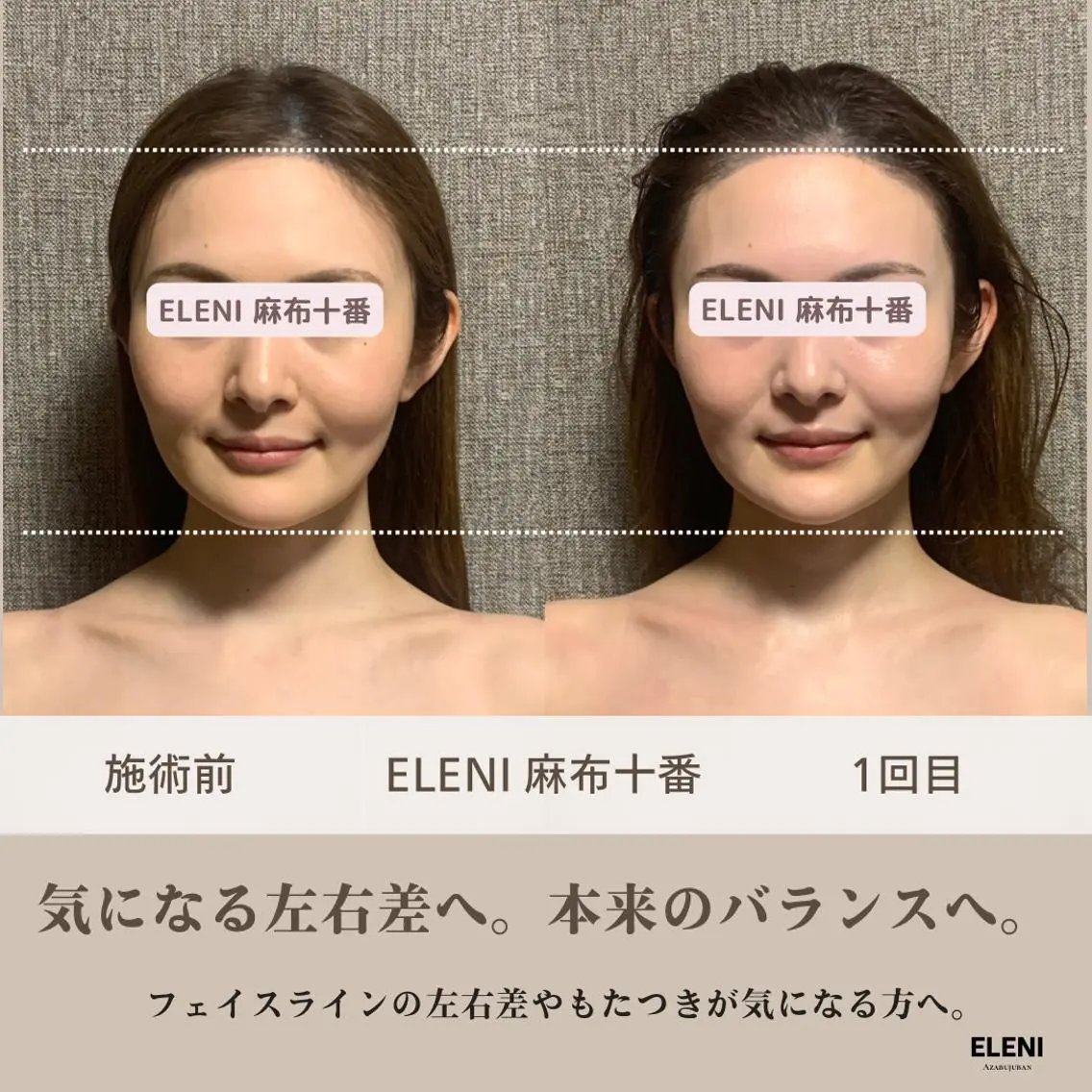 🎁口コミ投稿で施術10分延長🎁リフトアップ・左右差・エラ張り改善◎👑人気No.1★小顔矯正＋全身整体90分の写真