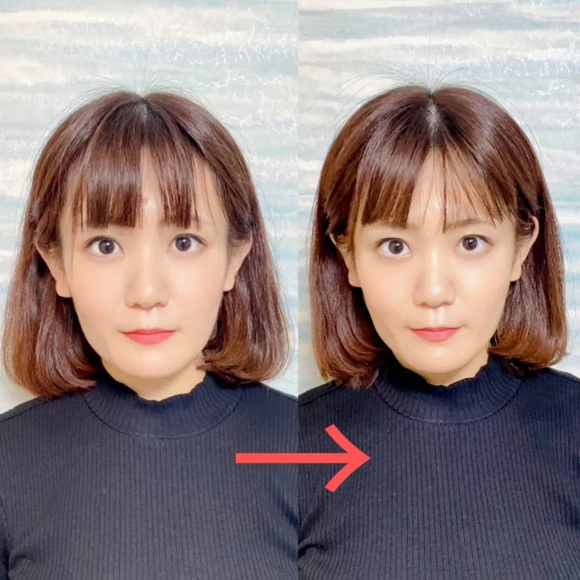 小顔矯正の撮影モデル募集！！の写真