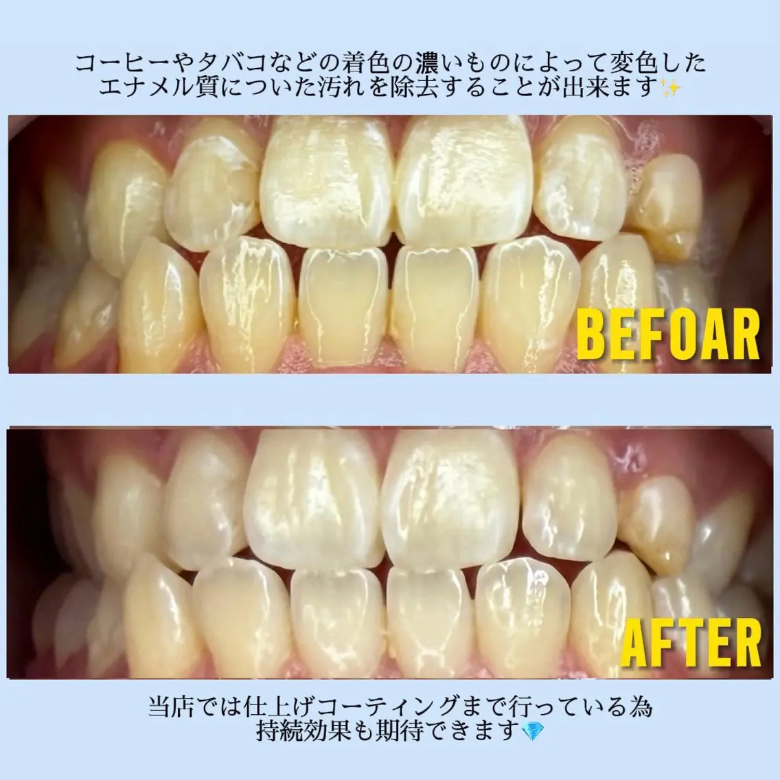 その他 ホワイトニングサロン MAYUのその他イメージ