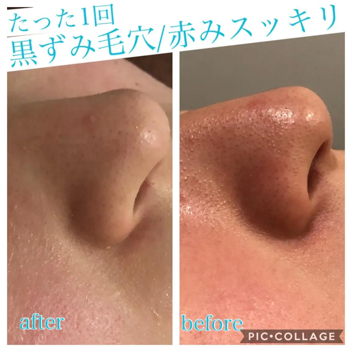ロング カラー パーマ ヘアアレンジ キッズ ネイル マツエク・マツパ エステ リラク EnsorClair 代表 野口真央のエステ・リラクイメージ