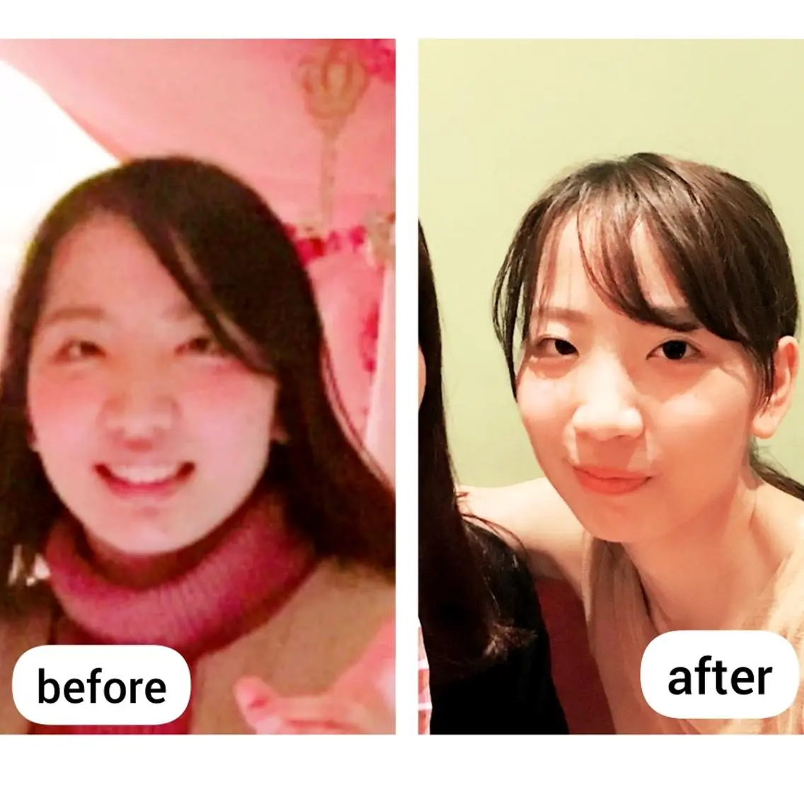 エステ 小顔&たるみアップ 専門店リラーシェのエステ・リラクイメージ