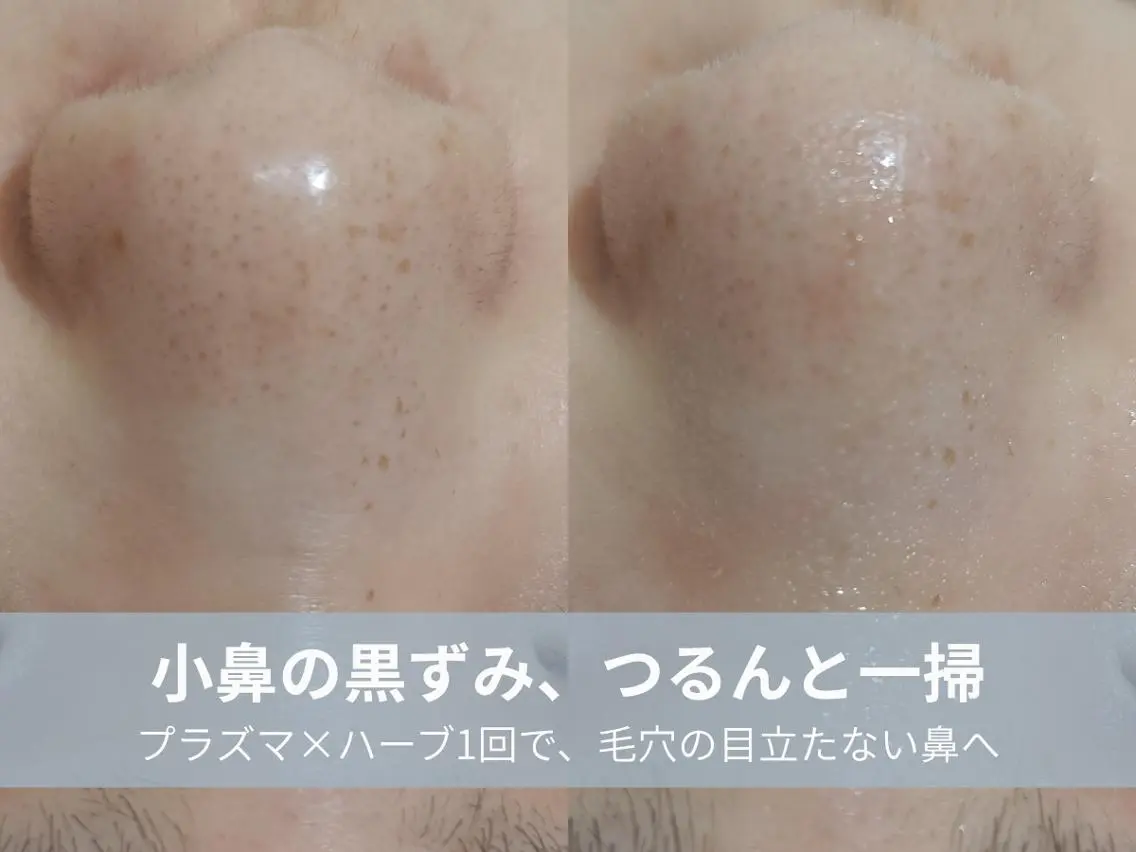 エステ La chic.のエステ・リラクイメージ