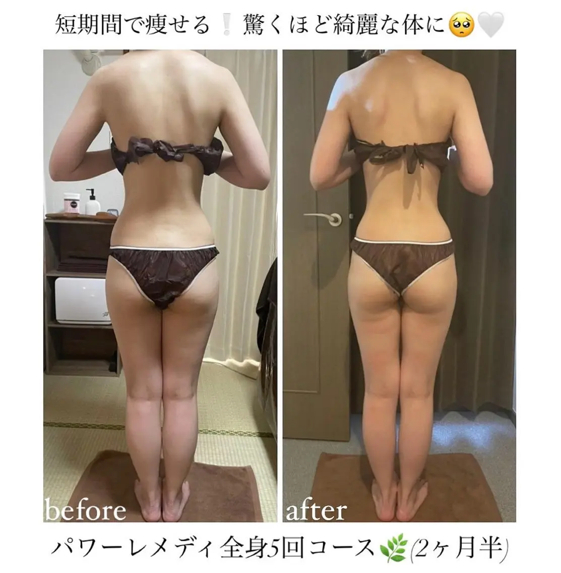 《本気痩せ×疲労改善 》  BILOOPのエステ・リラクイメージ